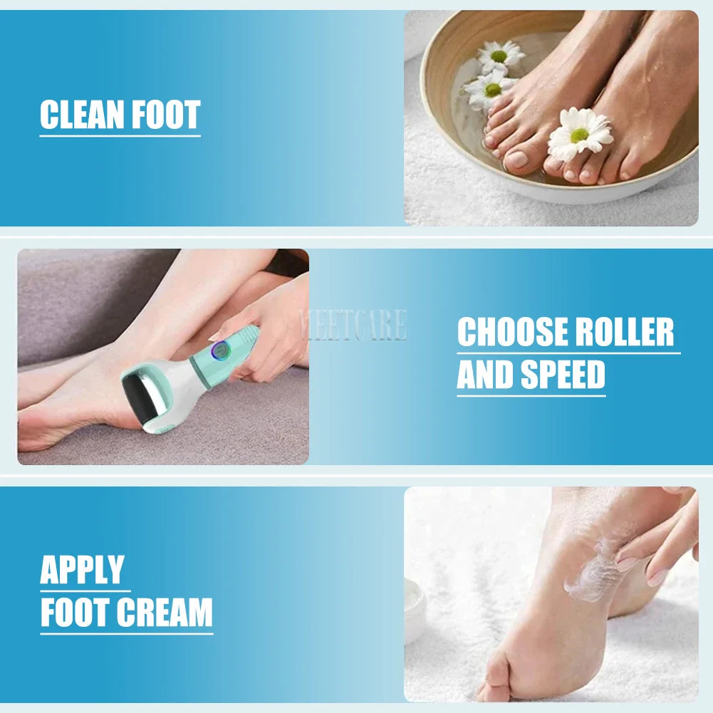 Zuky Pro-Electric Callus Remover