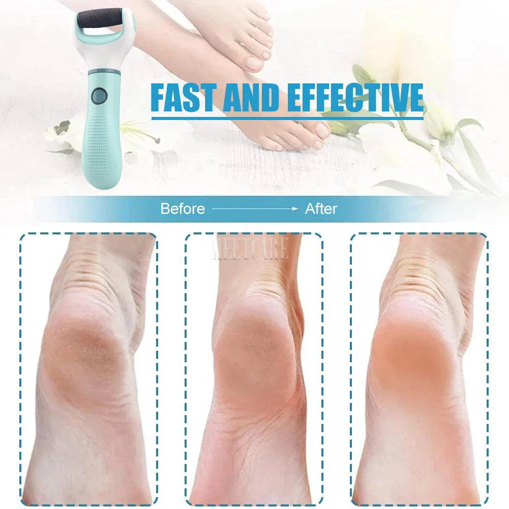 Zuky Pro-Electric Callus Remover